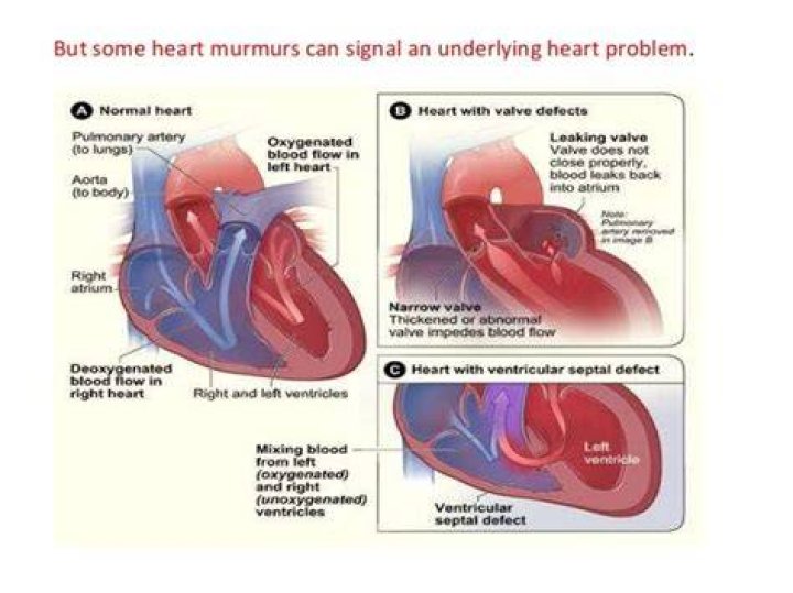 Murmur